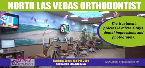 Our Site : http://www.aloha-orthodontics.com
Orthodontists advise parents to take their children to see North Las Vegas orthodontist at the earliest signs of orthodontic issues, or by the time they are seven years old. A younger child can achieve more progress with early treatment and the cost is less. If it is determined that early treatment is not necessary, the child can be monitored until treatment is necessary. The growth of the jaw and the facial bones can make a big difference in the type of treatment required.
My Social : https://twitter.com/Invisalignz
More Links : https://medium.com/@Invisalignz
https://kinja.com/lasvegasorthodontists
http://invisalign-las-vegas.sitey.me/