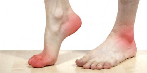 Awas kaki nyeri bisa jadi tanda serangan jantung